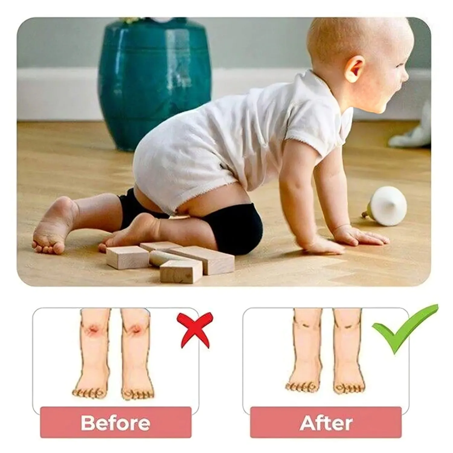 1 Pairs Baby Knee Pads for Crawling (1 Pair / 6 Cm)